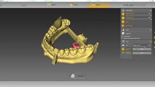 inLab Software 18 Webinar [upl. by Suzan]