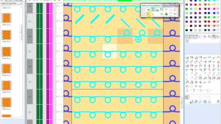 Stoll M1 Plus Pattern Presentations [upl. by Garibald]