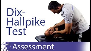 Dix Hallpike Test  Posterior BPPV [upl. by Stanfield]