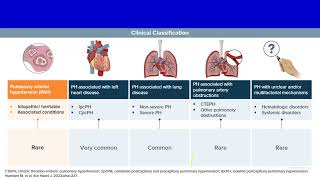 Connective tissue disease associated pulmonary hypertension Prof Mostafa Elshazly Chest Kasr ElAini [upl. by Salaidh]