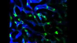 Example of laserinduced phototoxity in the liver [upl. by Eltsyrk]