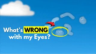 What are those floating things in your eyes  Eye Floaters Explained [upl. by Stan]