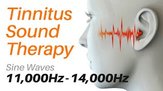 Tinnitus Sound Therapy  Sine Waves 11000Hz  14000Hz with Screensavers [upl. by Anay830]