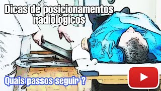 21 Prova ou entrevista na Radiologia Dicas de posicionamentos radiológicos [upl. by Nawtna617]