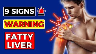 9 SIGNS Warning FATTY Liver Issues  HealthHarmony Life [upl. by Sybil466]