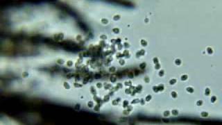 water mold zoospores [upl. by Nauaj]