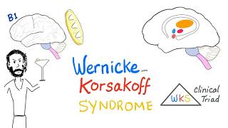 WernickeKorsakoff Syndrome WKS  Biochemistry  Diet and Nutrition [upl. by Ayaj]