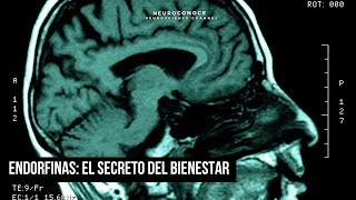 Endorfinas La ciencia del bienestar y la felicidad natural [upl. by Eimat]