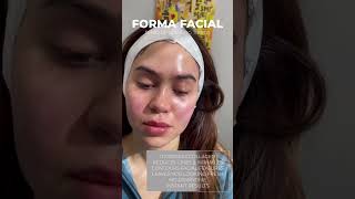 Forma Facial at Skin Tightening Botox and Lip Fillers by Skinsation LA in Los Angeles CA [upl. by Alam]