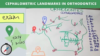 cephalometric landmarks in orthodontics [upl. by Hereld]