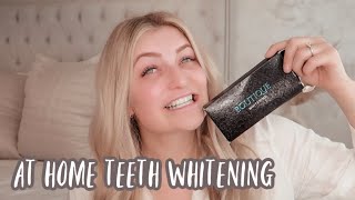 At Home Teeth Whitening  Boutique Whitening  My Teeth Bleaching Journey [upl. by Gentry]