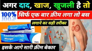 दाद खाज खुजली की बेस्ट क्रीम  micogel cream  micogel cream uses in hindi  miconazole nitrate [upl. by Aeresed]