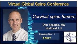 Cervical spine tumors with Dr Dan Sciubba MD [upl. by Lorien]