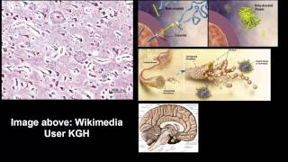 Biological basis of alzheimers disease [upl. by Scarito662]