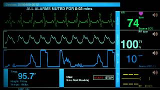 Sonido De Un Hospital [upl. by Fiedling]