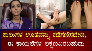 Swollen Feet and Ankles Causes amp Symptoms  Vijay Karnataka [upl. by Cirtemed]