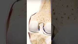 Movement of menisci anterior and posterior cruciate ligament of kneeshortsmedicosshort [upl. by Romelle]