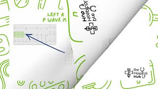 ECGs P Waves [upl. by Colwin]