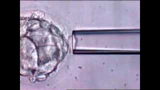 EMBRYO BIOPSY VIDEO [upl. by Anitac205]