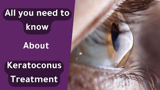 Essential Keratoconus Treatment Options Every Patient Needs to Know  علاج القرنية المخروطية [upl. by Atekehs]