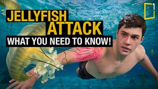 The Shocking Truth About Jellyfish Stings and How to Avoid Them [upl. by Yer712]