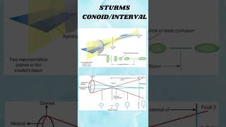 Astigmatism shortvideio viralshort ytshorts [upl. by Nna]