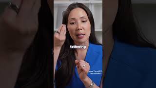 Tretinoin for Acne Scars Part II [upl. by Schatz]