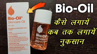 BioOil Full Review  कैसे लगाए कबतक लगाना है नुकसान  Hindi Review biooil [upl. by Olva884]