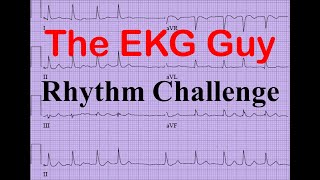 EKGECG  Rhythm Challenge 20  The EKG Guy [upl. by Norah126]