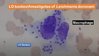 LD bodies Amastigotes of Leishmania donovani in skin smear of a cutaneous leishmaniasis patient [upl. by Shien30]