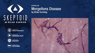 Morgellons Disease [upl. by Juno]