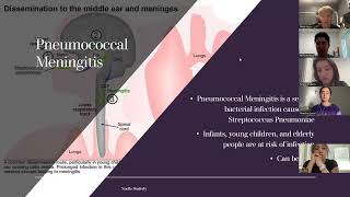 Bacterial meningitis presentation [upl. by Helman]