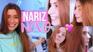 VLOG MINHA RINOPLASTIA CIRURGIA NO NARIZ [upl. by Rombert604]