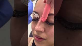 Straighten your nose without surgery [upl. by Navar]