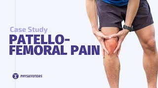 Patellofemoral Pain Case Study [upl. by Eibo283]