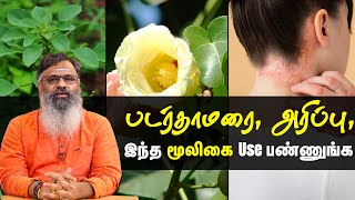 Ringworm Treatment At Home  படர்தாமரை பரவுவதை எவ்வாறு தடுப்பது  Advice from Dr K Gowthaman [upl. by Tarsuss]