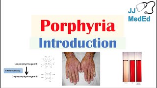 Introduction to Porphyria  Porphyria Cutanea Tarda vs Acute Intermittent Porphyria [upl. by Jakoba]