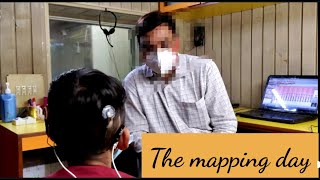 The mapping Day The cochlear implant processor mappingAB processor mapping [upl. by Ayanahs]