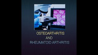 Osteoarthritis amp Rheumatoid arthritis osteoarthritis rheumatoidarthritis bonesandjoints [upl. by Ayel42]