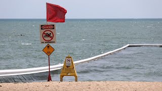 Teenager stung by deadly jellyfish in Far North Queensland [upl. by Prentiss888]