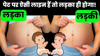 पेट पर ऐसी लाइन हैं तो लड़का ही होगाsymptoms of baby boypregnancy [upl. by Nanam]