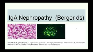 IgA Nephropathy  Berger disease [upl. by Engedi]