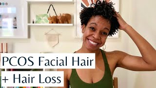 PCOS Facial Hair and Hair Loss  Causes Treatments amp Natural Ways to Reduce Hirsutism amp Hair Loss [upl. by Lleumas291]