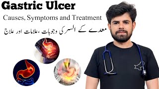 Gastric Ulcer Stomach Ulcer معدے کا السرCauses Symptoms and Treatment Doc Saqi Nishtarian [upl. by Llemhar]