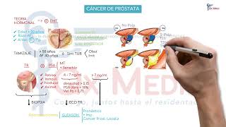 Urología  03 Neoplasia en próstata [upl. by Vilberg]