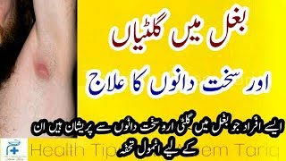 Bagal main Giltion aur Dano ka ilaj  Health tips in urdu Gilti ka ilaj [upl. by Milano]