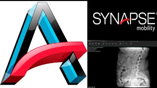 Tutorial para Synapse Mobility PC [upl. by Millwater]