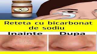 🍀Reteta cu bicarbonat de sodiu si ulei de cocos care va scapa de riduri punctele negre si de petele [upl. by Hsemin697]