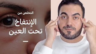 اسباب وحلول الانتفاخ تحت العين 👁️ منتجات عناية بالبشرة  تمارين  أدوات [upl. by Nauaj]