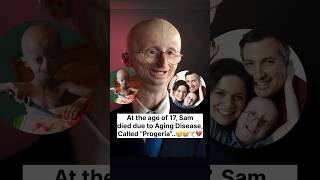 SAM BERNS✨❤️  Life Journey  shorts successstory motivation samberns journey ytshorts [upl. by Livvi]